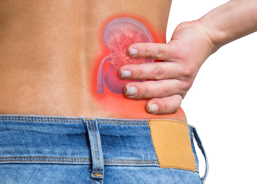 Can Homeopathic Medicines Help Reduce Pain From kidney Stones?