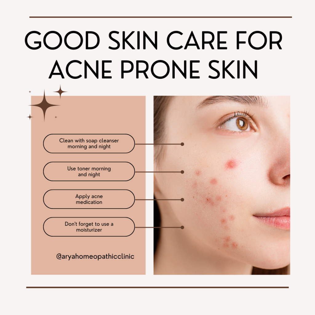 What I want people with acne to know
